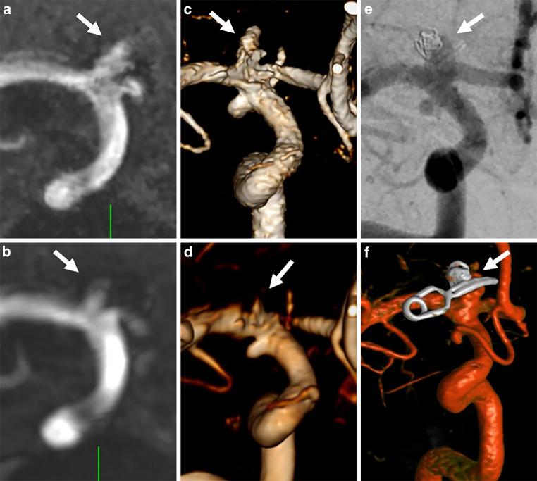 https://cdn.ncbi.nlm.nih.gov/pmc/blobs/7c86/10654166/adc325c428df/62_2023_1320_Fig3_HTML.jpg