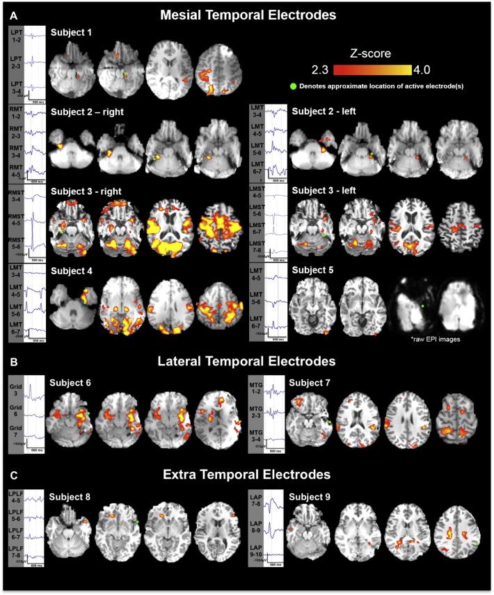 https://cdn.ncbi.nlm.nih.gov/pmc/blobs/7c86/4375646/3d20953dfc81/gr2.jpg