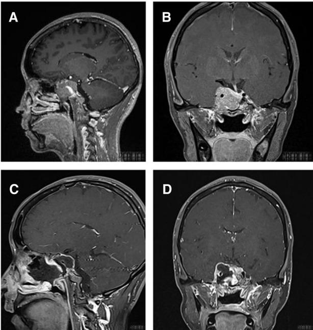 https://cdn.ncbi.nlm.nih.gov/pmc/blobs/7c8d/9537740/5338f24fb128/fsurg-09-996290-g004.jpg