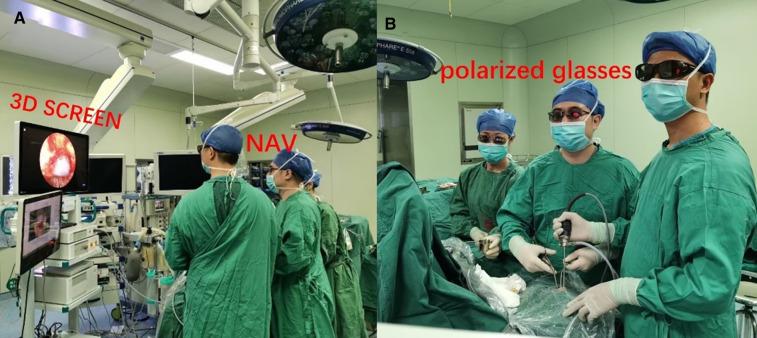 https://cdn.ncbi.nlm.nih.gov/pmc/blobs/7c8d/9537740/afcd64e03f9a/fsurg-09-996290-g001.jpg