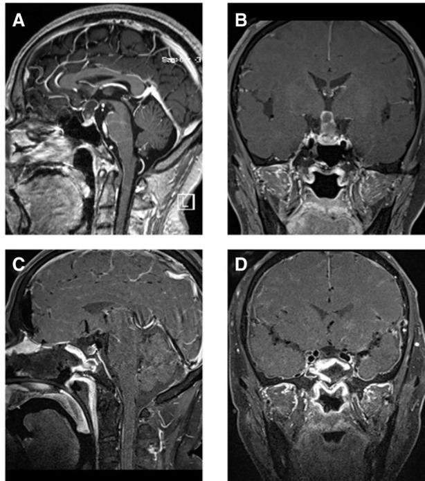 https://cdn.ncbi.nlm.nih.gov/pmc/blobs/7c8d/9537740/c6117ee4275b/fsurg-09-996290-g002.jpg
