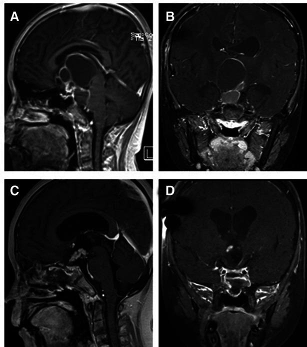 https://cdn.ncbi.nlm.nih.gov/pmc/blobs/7c8d/9537740/d63b4b779ea6/fsurg-09-996290-g006.jpg