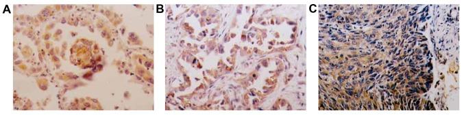 https://cdn.ncbi.nlm.nih.gov/pmc/blobs/7c8e/5530090/80663669a791/ol-14-02-1989-g02.jpg