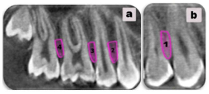 https://cdn.ncbi.nlm.nih.gov/pmc/blobs/7c91/12110168/bdc75cda7411/diagnostics-15-01252-g001.jpg
