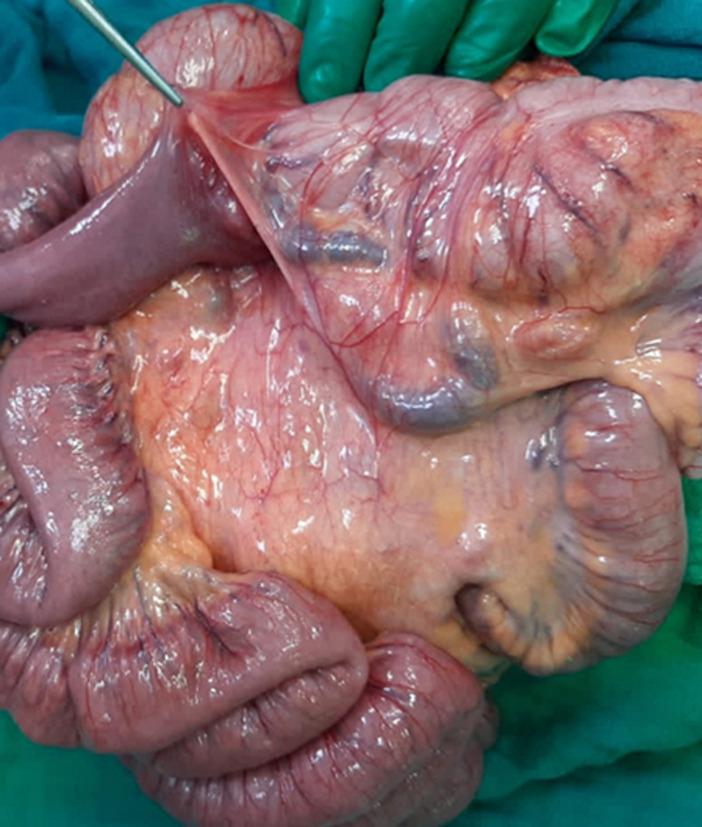 https://cdn.ncbi.nlm.nih.gov/pmc/blobs/7c98/10998253/3483362cfe97/PAMJ-47-34-g003.jpg