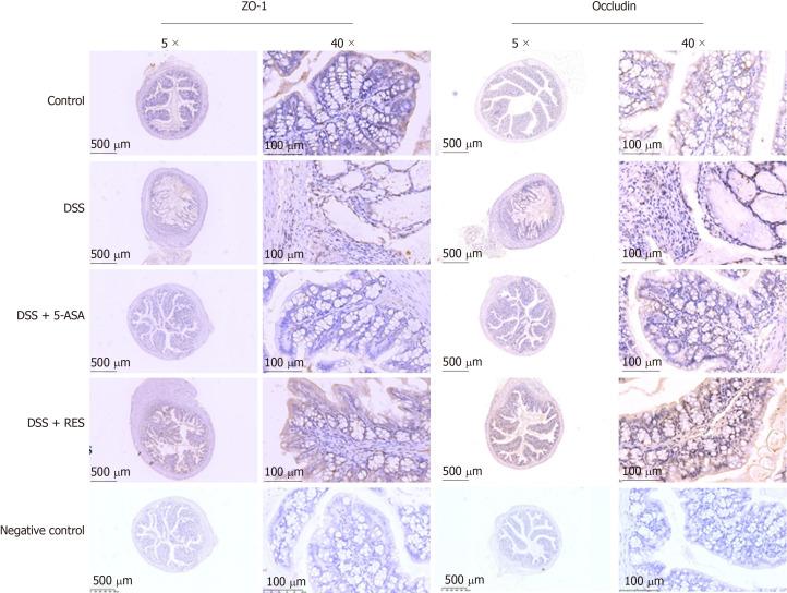 https://cdn.ncbi.nlm.nih.gov/pmc/blobs/7c99/7476174/5a00893fa3c3/WJG-26-4945-g005.jpg