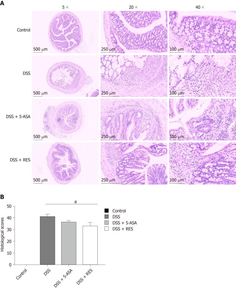 https://cdn.ncbi.nlm.nih.gov/pmc/blobs/7c99/7476174/6a35b0b99c51/WJG-26-4945-g004.jpg