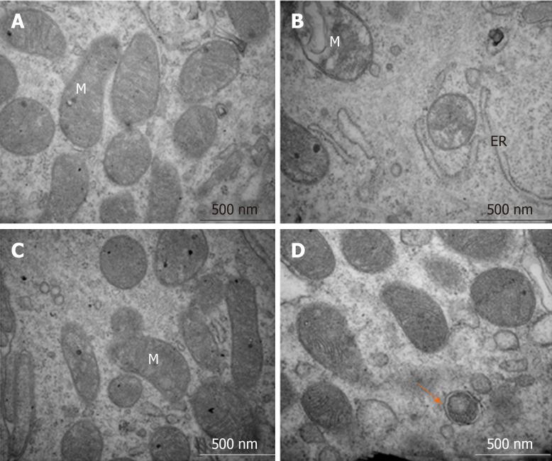 https://cdn.ncbi.nlm.nih.gov/pmc/blobs/7c99/7476174/d3b5b8841e17/WJG-26-4945-g007.jpg