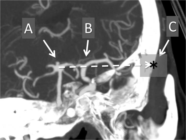 https://cdn.ncbi.nlm.nih.gov/pmc/blobs/7ca7/5177669/bc73c25c17a8/701_2016_3018_Fig1_HTML.jpg