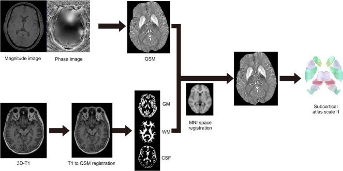 https://cdn.ncbi.nlm.nih.gov/pmc/blobs/7cb7/12175199/46f0036ff616/HBM-46-e70263-g006.jpg