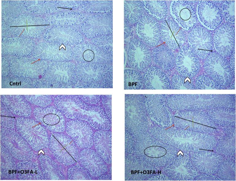 https://cdn.ncbi.nlm.nih.gov/pmc/blobs/7cb9/10548221/588cd3ffdbb7/fendo-14-1256154-g001.jpg