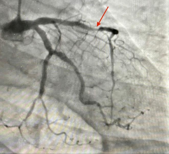 https://cdn.ncbi.nlm.nih.gov/pmc/blobs/7cbf/11164672/8a8bfe911e40/CCR3-12-e8968-g001.jpg
