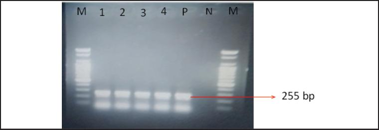 https://cdn.ncbi.nlm.nih.gov/pmc/blobs/7ccc/11296175/5cc091bf2551/JAVAR-11-408-g003.jpg