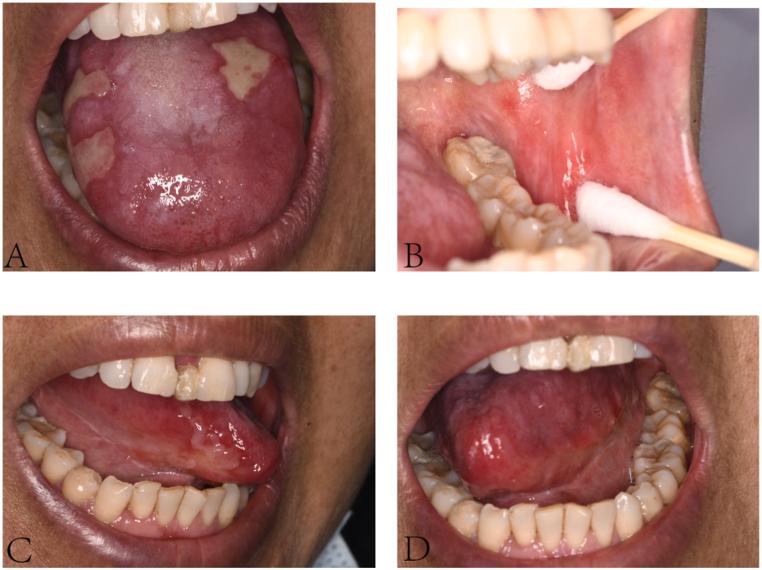 https://cdn.ncbi.nlm.nih.gov/pmc/blobs/7cd4/10818186/e25e302e7026/gr2.jpg