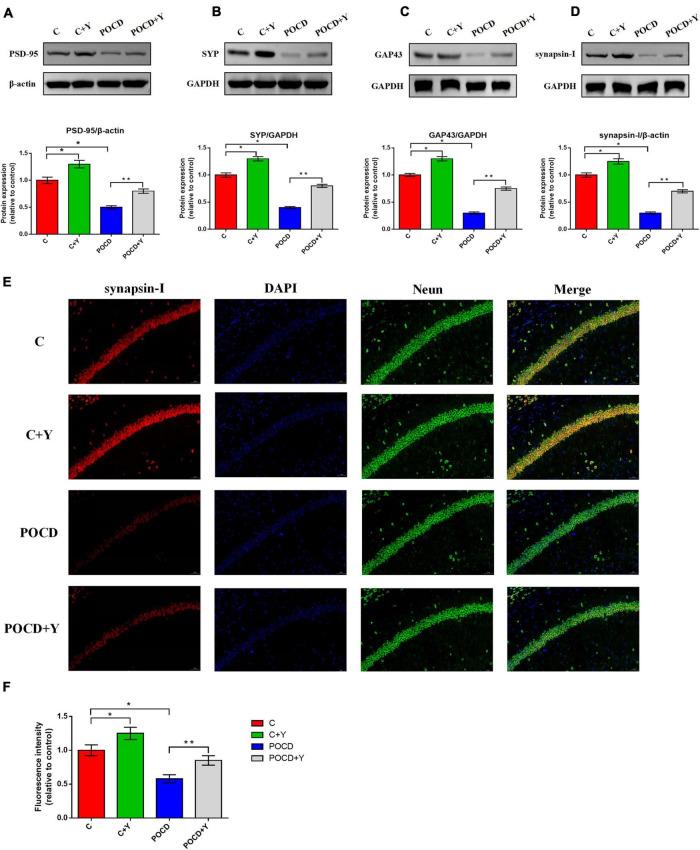 https://cdn.ncbi.nlm.nih.gov/pmc/blobs/7cd4/9485610/7ebdbe4bd317/fnagi-14-996223-g007.jpg