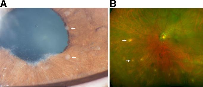 https://cdn.ncbi.nlm.nih.gov/pmc/blobs/7cd5/8254127/8c67dcd3c07c/gr3.jpg