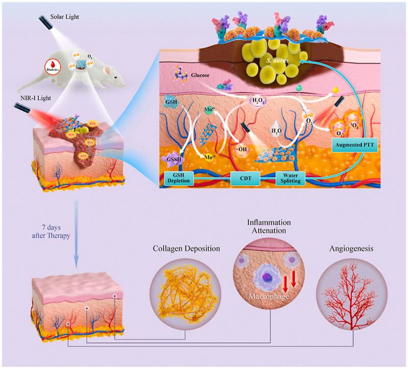 https://cdn.ncbi.nlm.nih.gov/pmc/blobs/7cd6/10087611/70e4a1e165a5/ga1.jpg