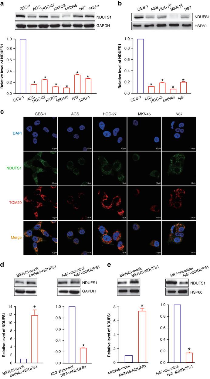 https://cdn.ncbi.nlm.nih.gov/pmc/blobs/7cdb/10575981/6ebf2cfd655f/41416_2023_2409_Fig2_HTML.jpg