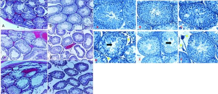 https://cdn.ncbi.nlm.nih.gov/pmc/blobs/7cdb/12307235/055f25cb0967/FSN3-13-e70705-g001.jpg