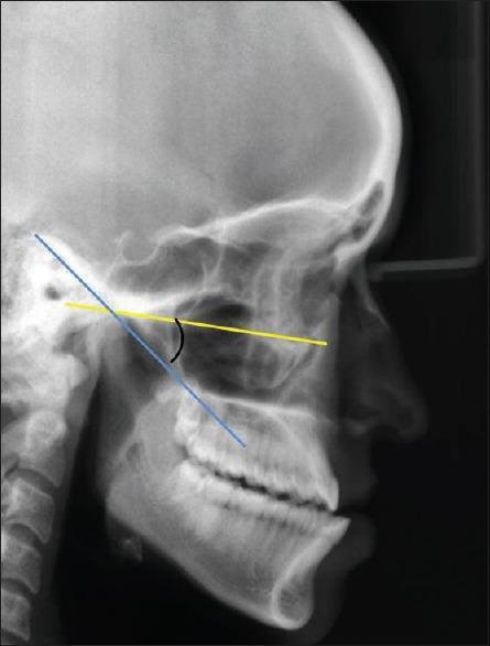 https://cdn.ncbi.nlm.nih.gov/pmc/blobs/7cdb/4837772/15429c6aab80/JIPS-16-148-g004.jpg