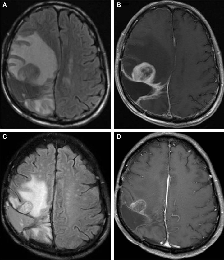 https://cdn.ncbi.nlm.nih.gov/pmc/blobs/7cdb/5317326/3c7b2238ab21/ott-10-837Fig5.jpg