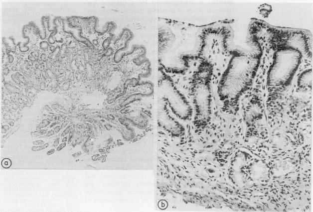 https://cdn.ncbi.nlm.nih.gov/pmc/blobs/7ce5/502359/76f906382e24/jclinpath00394-0041-a.jpg