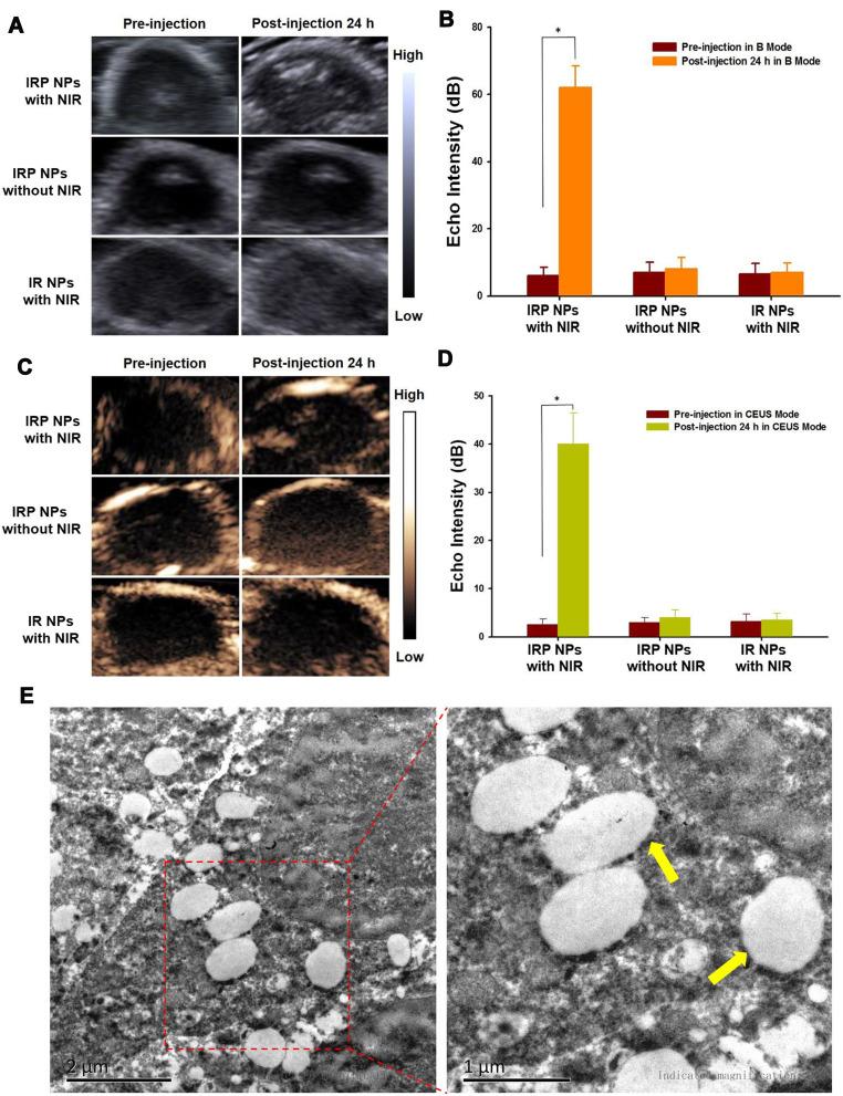 https://cdn.ncbi.nlm.nih.gov/pmc/blobs/7cf0/7652575/ad7d16e2e84b/IJN-15-8641-g0007.jpg
