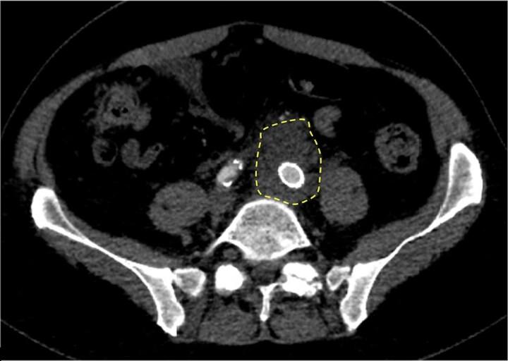https://cdn.ncbi.nlm.nih.gov/pmc/blobs/7cf1/12281501/ca54ae385c26/ofaf404f2.jpg