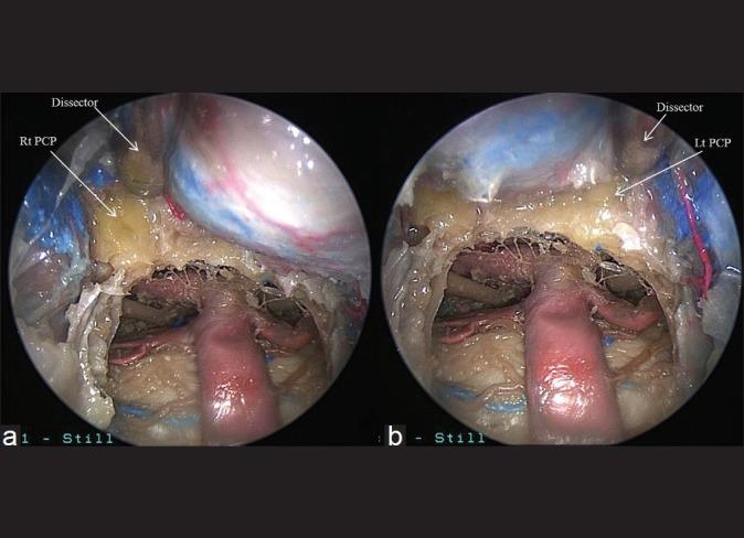 https://cdn.ncbi.nlm.nih.gov/pmc/blobs/7cf5/3385065/a11d63824375/SNI-3-64-g006.jpg