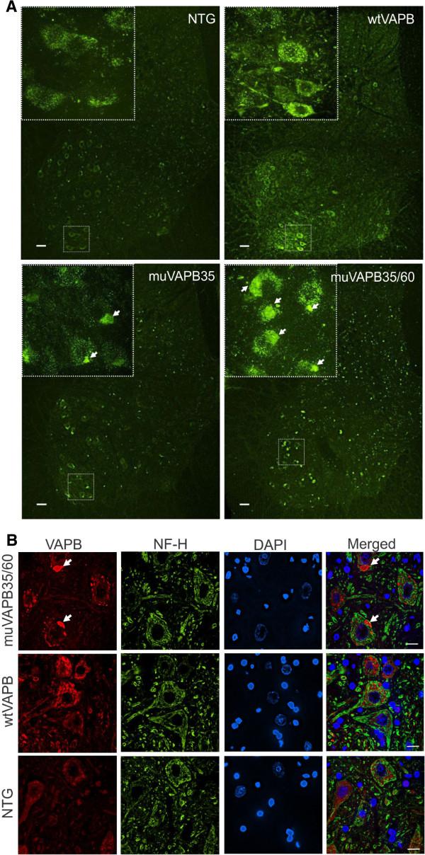 https://cdn.ncbi.nlm.nih.gov/pmc/blobs/7cfd/3538568/8318829b319b/1750-1326-8-1-2.jpg