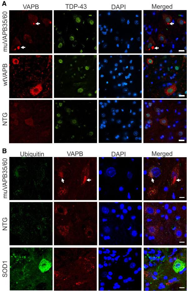 https://cdn.ncbi.nlm.nih.gov/pmc/blobs/7cfd/3538568/998b099a593e/1750-1326-8-1-5.jpg