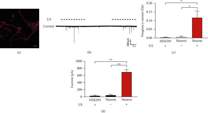 https://cdn.ncbi.nlm.nih.gov/pmc/blobs/7d0b/8041518/ddd8699e4d22/NP2021-8855055.002.jpg