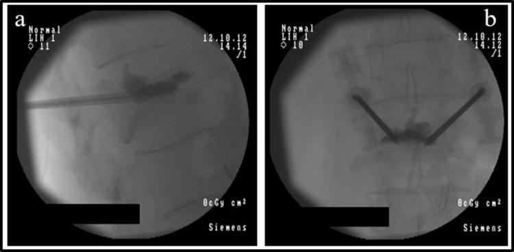 https://cdn.ncbi.nlm.nih.gov/pmc/blobs/7d11/10202202/612b722ce4be/JPR-16-1663-g0003.jpg