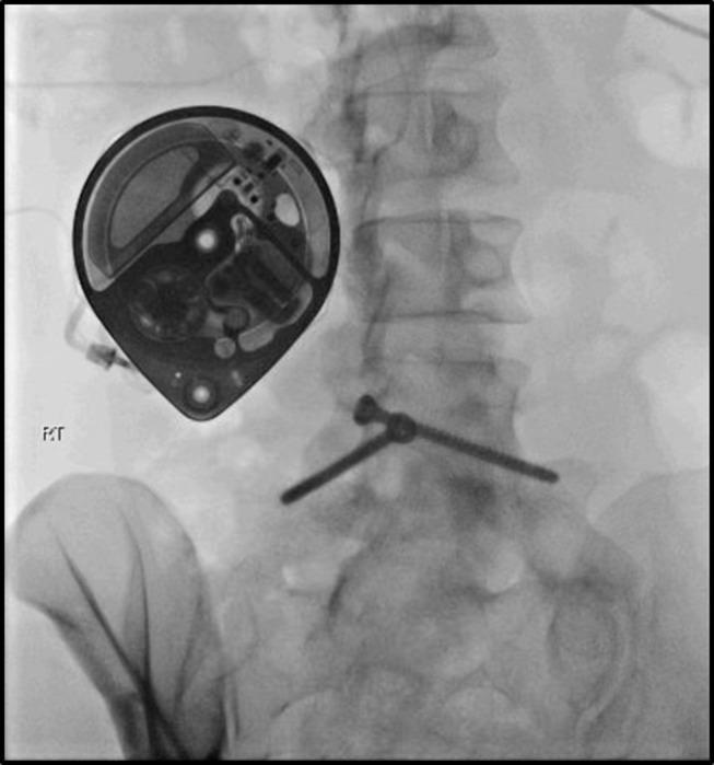 https://cdn.ncbi.nlm.nih.gov/pmc/blobs/7d11/10202202/bcc677891f43/JPR-16-1663-g0004.jpg