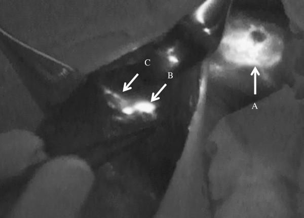 https://cdn.ncbi.nlm.nih.gov/pmc/blobs/7d25/3527301/96b0967e4431/1477-7819-10-233-1.jpg