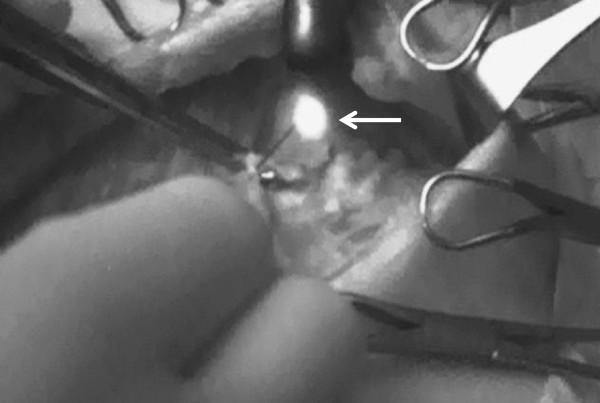 https://cdn.ncbi.nlm.nih.gov/pmc/blobs/7d25/3527301/cac9f4ece5b7/1477-7819-10-233-3.jpg