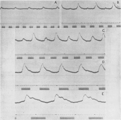 https://cdn.ncbi.nlm.nih.gov/pmc/blobs/7d26/1394523/4290a8848953/jphysiol01602-0131-a.jpg
