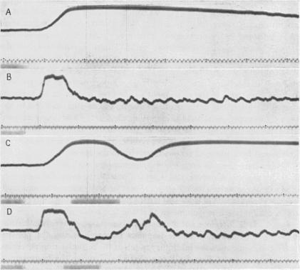 https://cdn.ncbi.nlm.nih.gov/pmc/blobs/7d26/1394523/be0126aa774d/jphysiol01602-0121-a.jpg