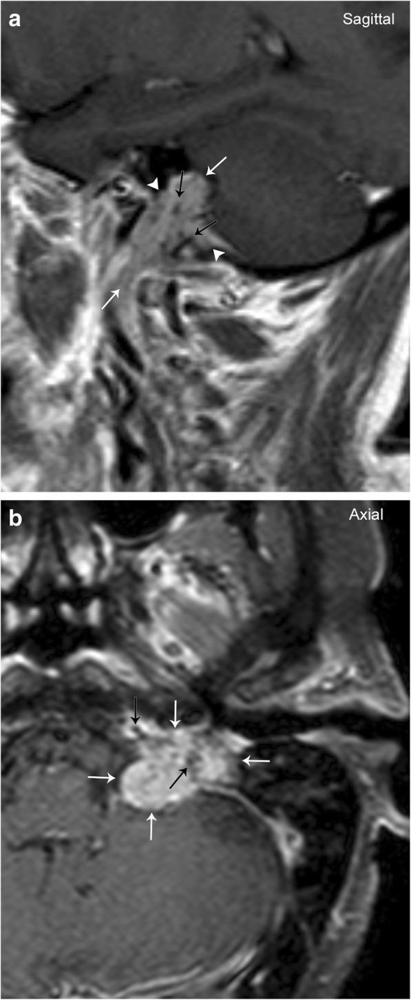 https://cdn.ncbi.nlm.nih.gov/pmc/blobs/7d35/6377693/29738d9b7476/13244_2019_704_Fig3_HTML.jpg