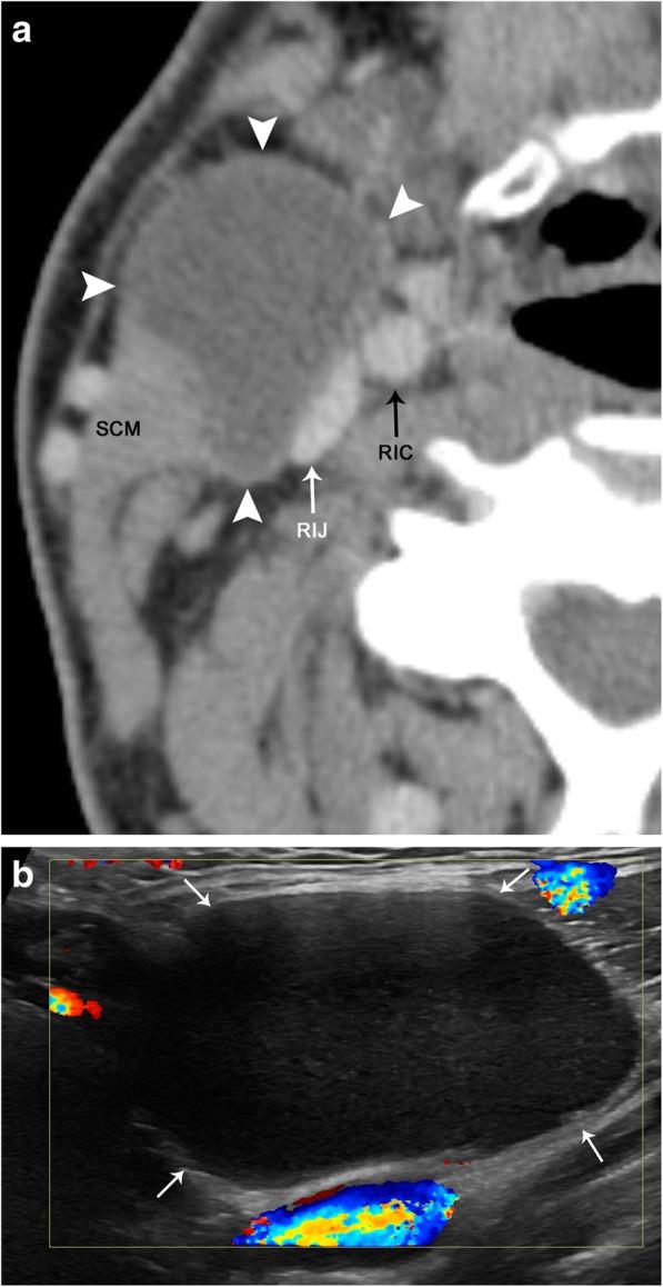 https://cdn.ncbi.nlm.nih.gov/pmc/blobs/7d35/6377693/d088364d6b7d/13244_2019_704_Fig23_HTML.jpg