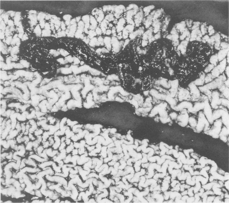 https://cdn.ncbi.nlm.nih.gov/pmc/blobs/7d37/1789606/4e03736fcbf9/canvetj00323-0020-a.jpg