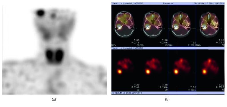 https://cdn.ncbi.nlm.nih.gov/pmc/blobs/7d41/6286763/7cc8f85b12ea/CRIOT2018-8619434.003.jpg