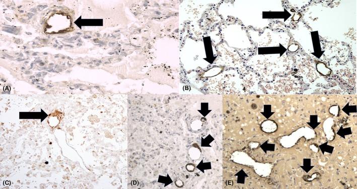 https://cdn.ncbi.nlm.nih.gov/pmc/blobs/7d46/11964584/92b7d89ad87e/HIS-86-845-g001.jpg