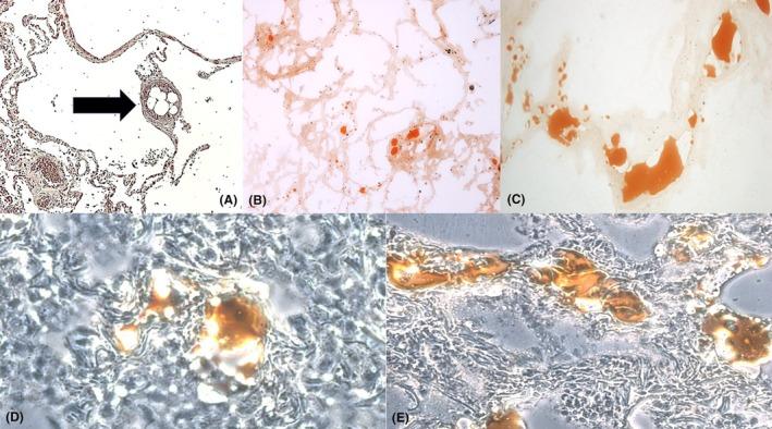 https://cdn.ncbi.nlm.nih.gov/pmc/blobs/7d46/11964584/f538561c36d0/HIS-86-845-g002.jpg