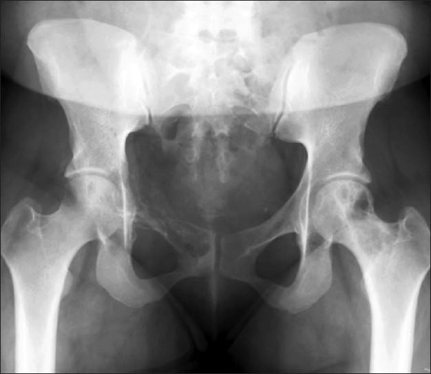 https://cdn.ncbi.nlm.nih.gov/pmc/blobs/7d48/2924529/75762da07f24/CJ-7-12-g001.jpg