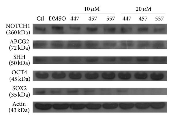 https://cdn.ncbi.nlm.nih.gov/pmc/blobs/7d4a/3918374/599b76907230/ECAM2014-494739.005.jpg