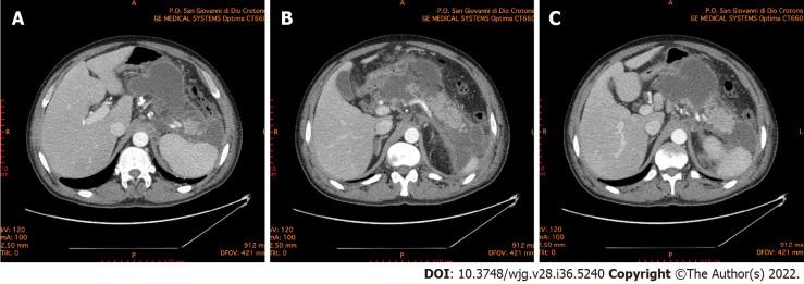 https://cdn.ncbi.nlm.nih.gov/pmc/blobs/7d4f/9521525/cd7b767666e4/WJG-28-5240-g001.jpg