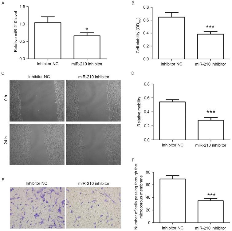 https://cdn.ncbi.nlm.nih.gov/pmc/blobs/7d51/5585723/a376302e4bb1/etm-14-04-2809-g02.jpg