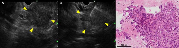 https://cdn.ncbi.nlm.nih.gov/pmc/blobs/7d58/12123552/d2777c18e16f/cureus-0017-00000083238-i03.jpg