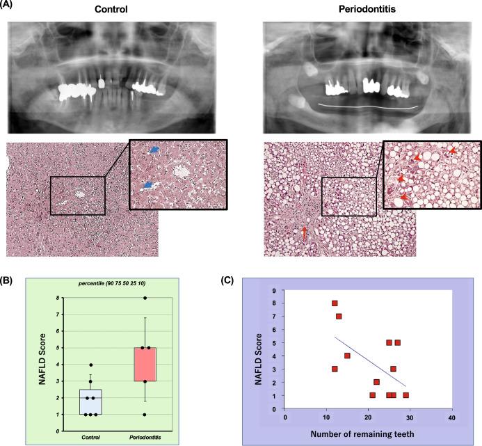 https://cdn.ncbi.nlm.nih.gov/pmc/blobs/7d5b/10794237/bd2196b311cf/41522_2024_476_Fig12_HTML.jpg
